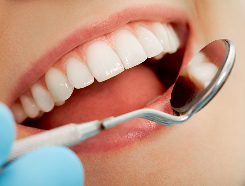 Mouth checkup Best Cosmetic Dentist in Ottawa Ontario