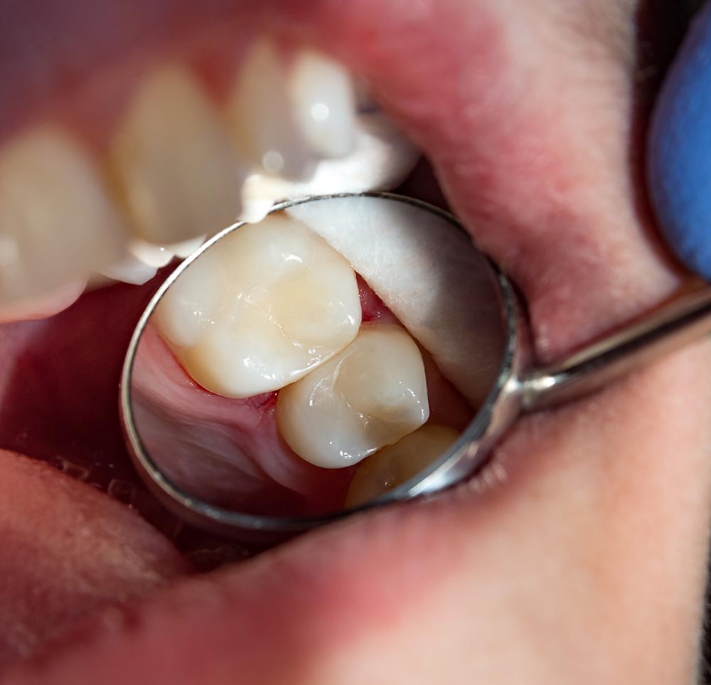 Cosmetic Dental Clinic in Ottawa Ontario Cosmetic Dental Clinic in Ottawa Ontario