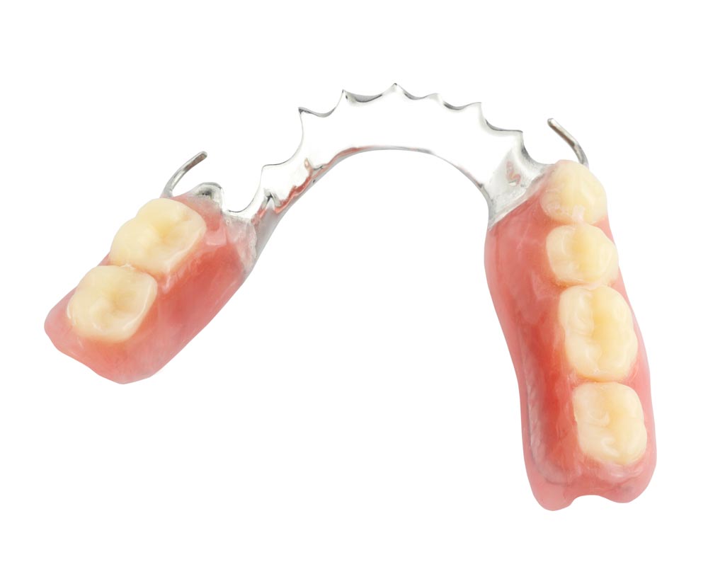 Partial Denture isolate Partial Denture isolate