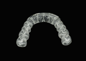 night_guards Dental Night Guard in Ottawa ON
